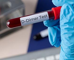blog//d-dimer-test