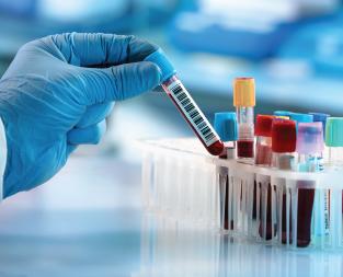 blog//ferritin-test