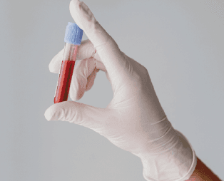 blog//complete-blood-count-cbc-types-ranges-and-preparations