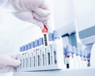 blog/what-is-hba1c-test