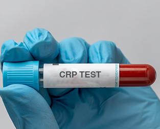 HRCT Chest Scan - Why, How to prepare And Procedure | HOD