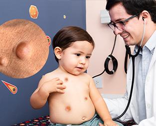 blog/neurofibromatosis