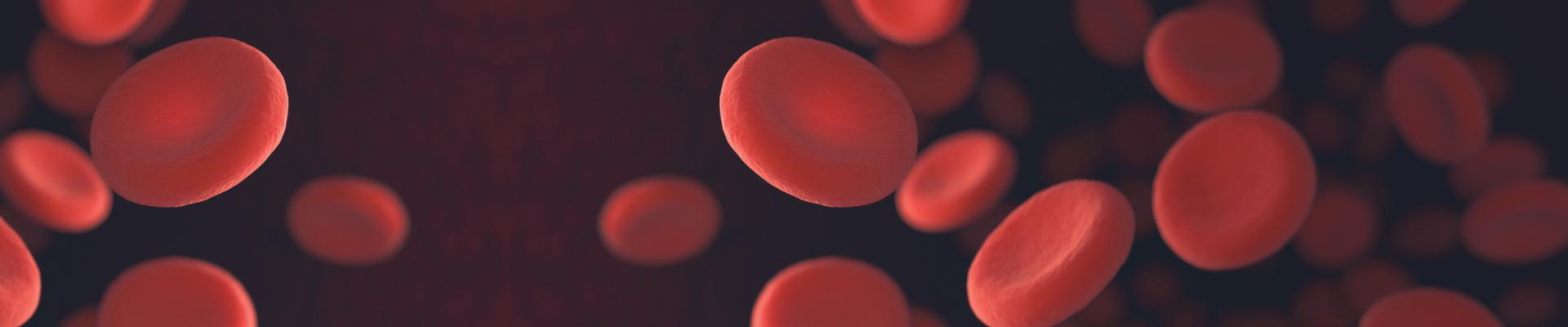 Anemia