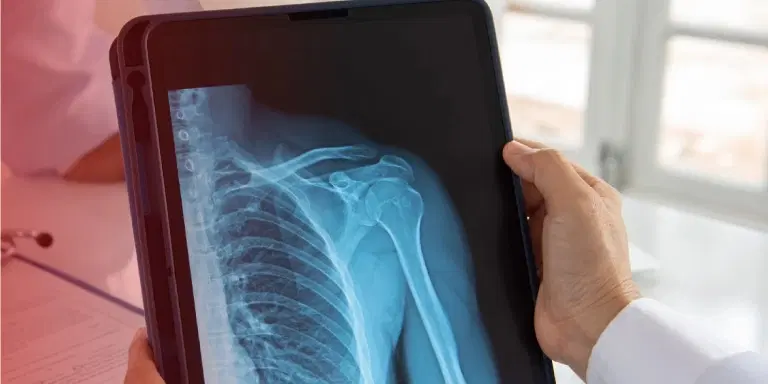 Digital Chest X-Ray Scan in Delhi NCR Cost ₹249 Onwards HOD