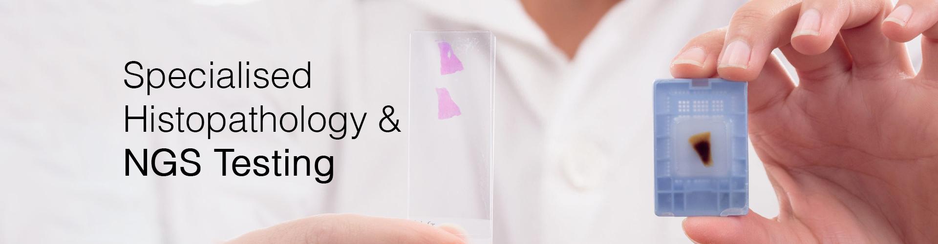 BRCA 1&2 Somatic Gene